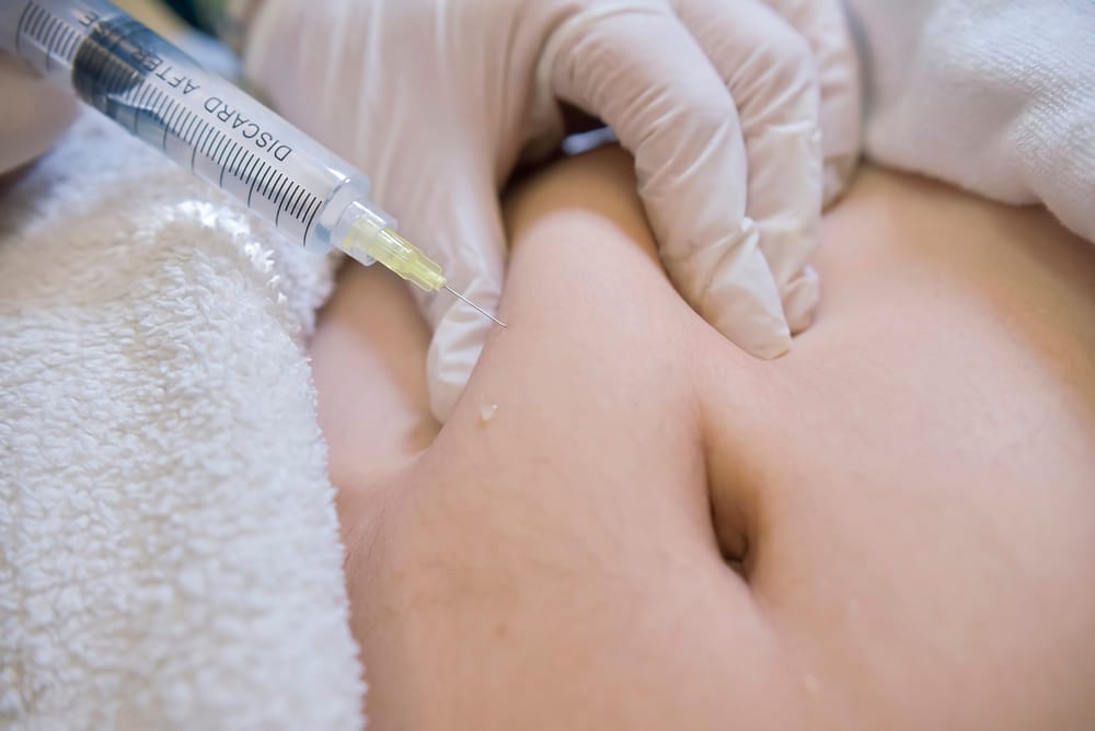 Close-up of a lipotropic injection into the subcutaneous fat below the navel