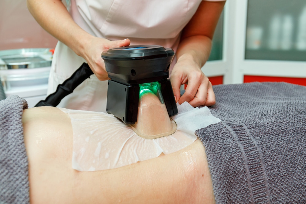 Cryolipolysis treatment by a beauty therapist