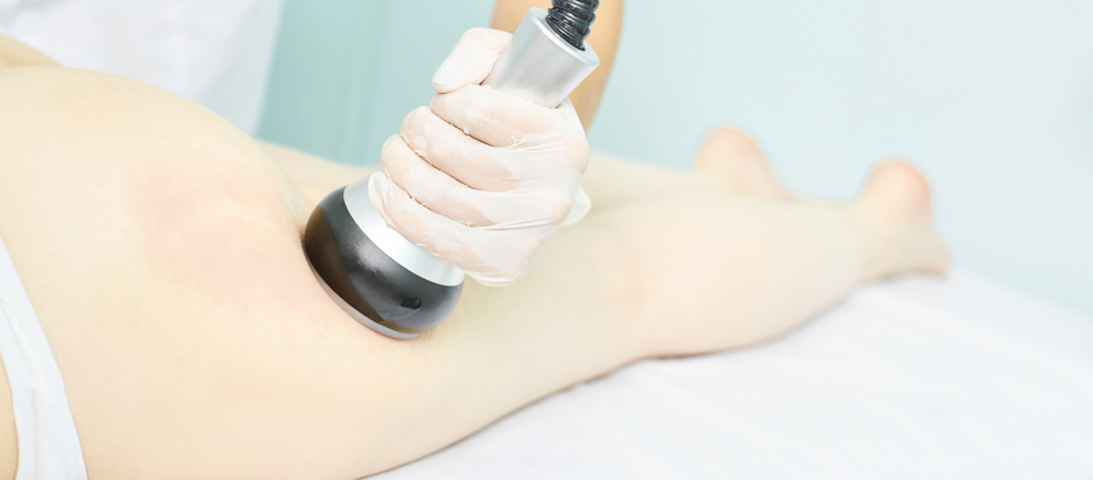 Laser Lipolysis for Arm Fat Removal